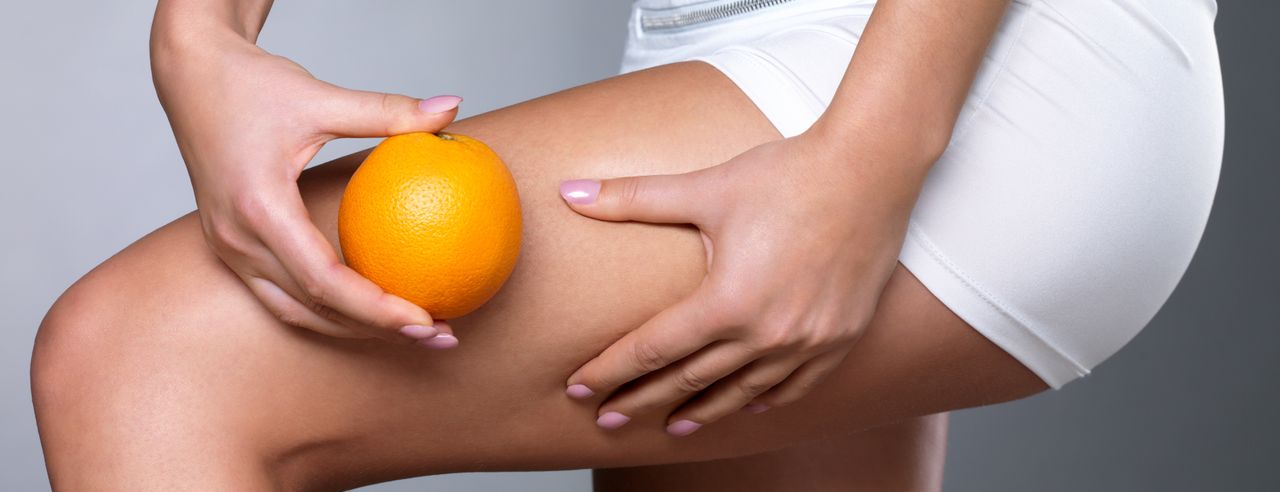 Eine Frau mit Cellulite hält eine Orange vor Ihrem Bein als Sinnbild für Orangenhaut (Cellulite)