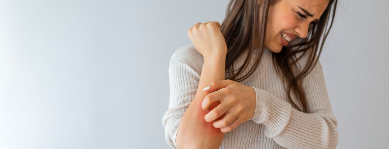 Eine Frau mit Psoriasis kratzt sich am Arm