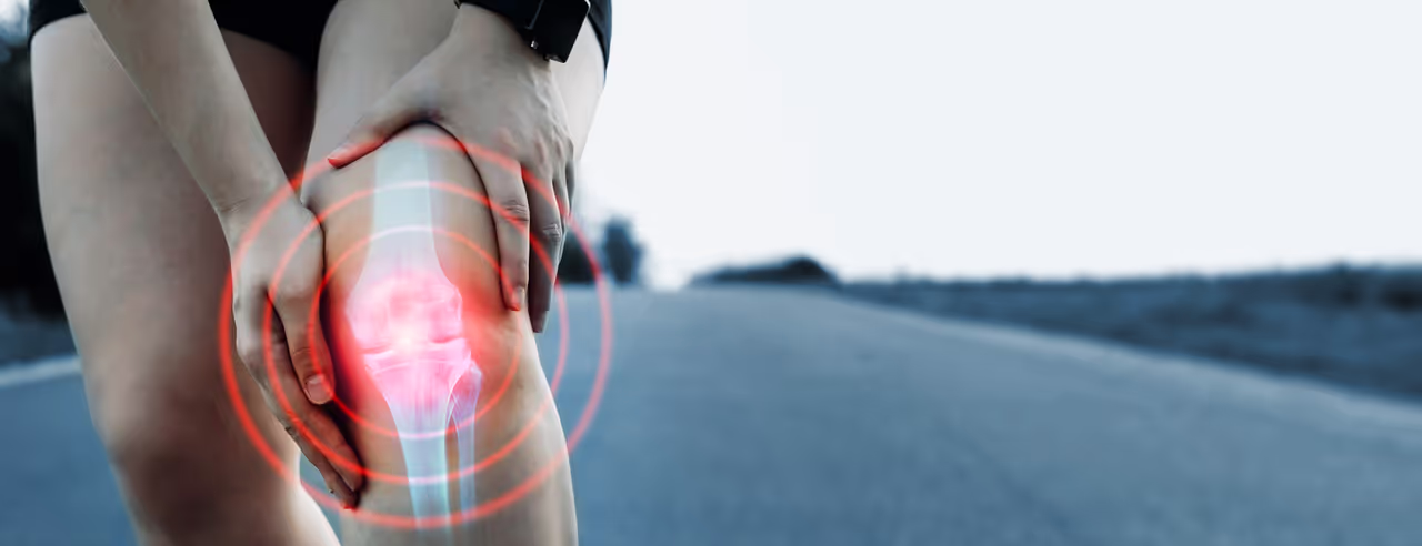 Visualizzazione dell'osteoartrite del ginocchio