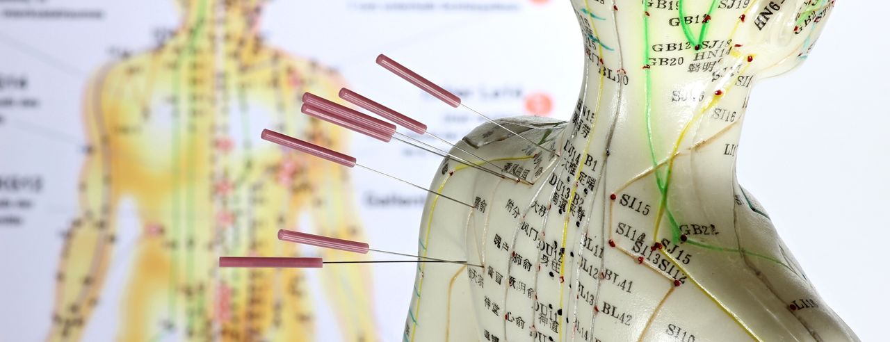 Akupunkturmodell mit Nadeln im Schulterbereich vor Lehrtafel.