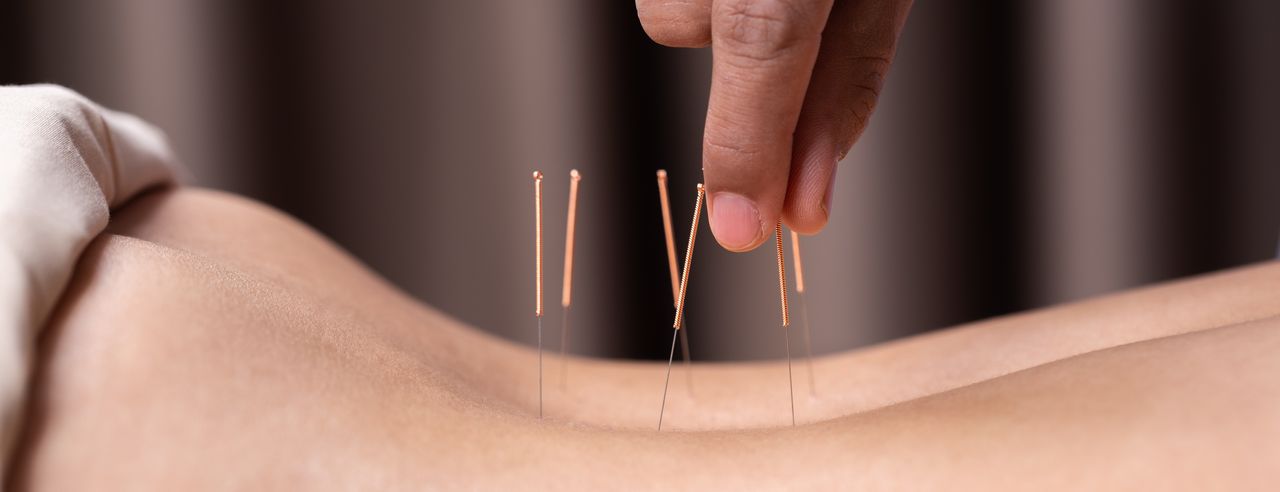 Acupunctuur op de rug