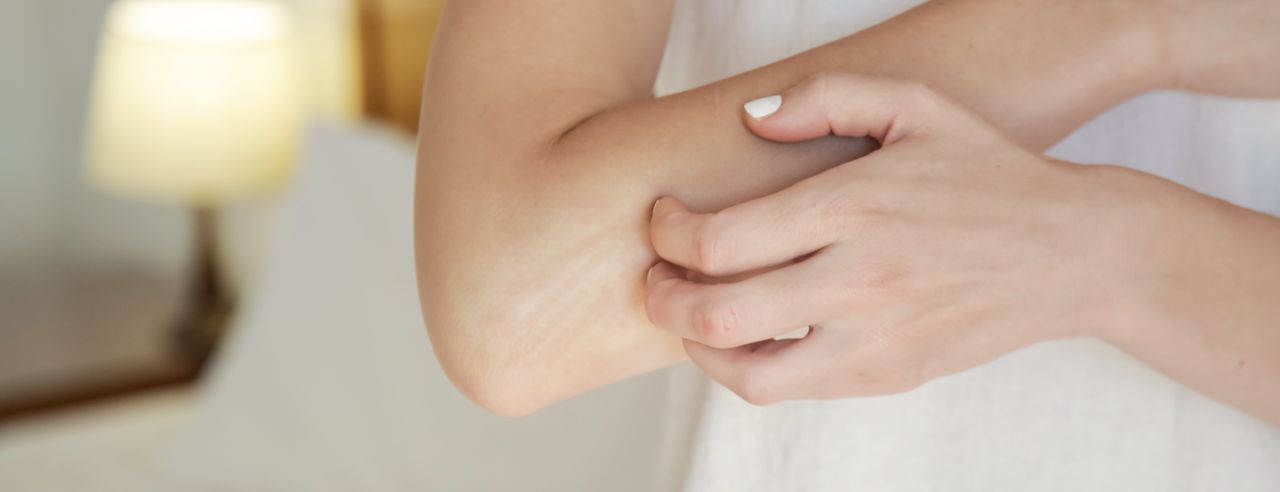 En kvinna med psoriasis kliar sig på armen