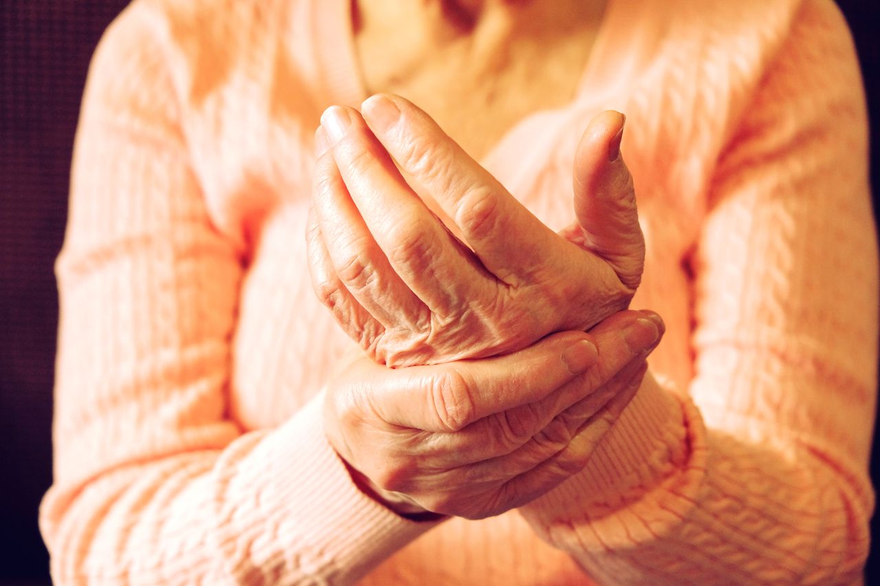 Arthritis treatment